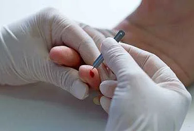 Инструменты: основные инструменты для взятия крови из пальца