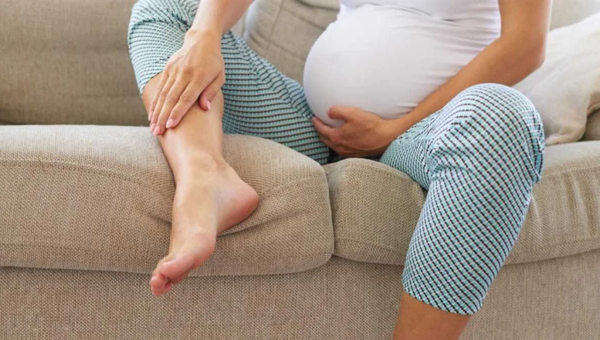 Причины развития варикоза у беременных
