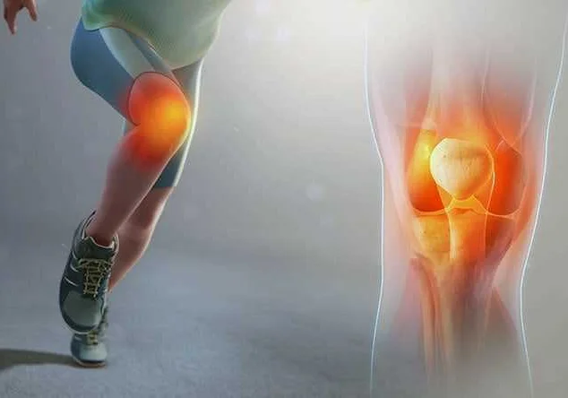 Лечение колена бегуна