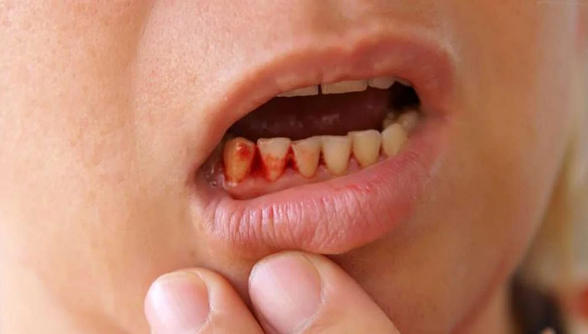 Эффективные способы лечения и профилактики утренних зубных болей