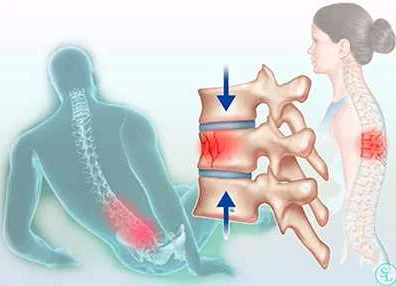 Методы диагностики травм спины