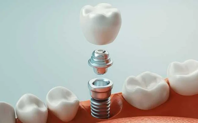 Ограничения и недостатки купона на стоматологические услуги